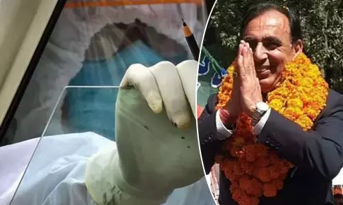 Himachal BJP MLA dies of post-Covid complications