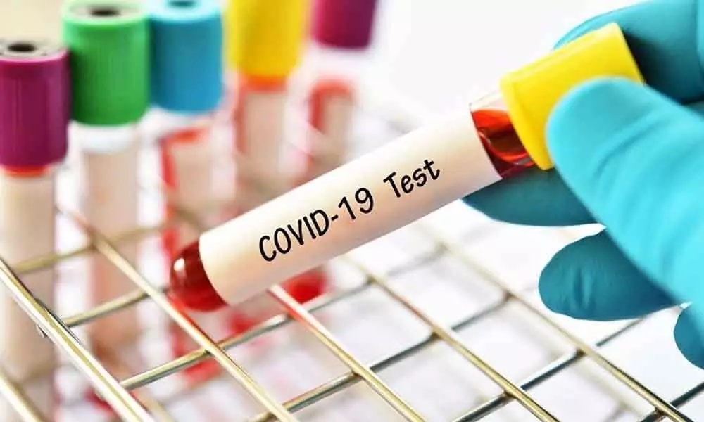 Covid-19: Karnataka logs 7,810 infections