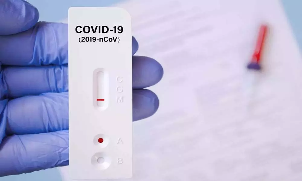 Amazon Covid test kit now available online
