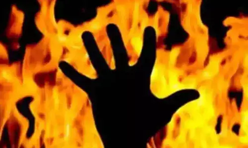 Family members set girl on fire over love affair in Rayachoti of Kadapa
