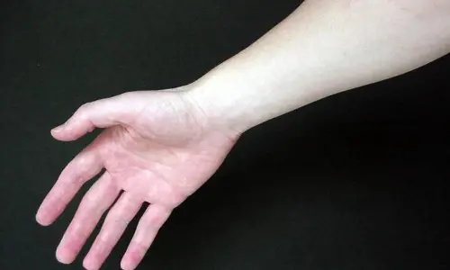 Representative Image