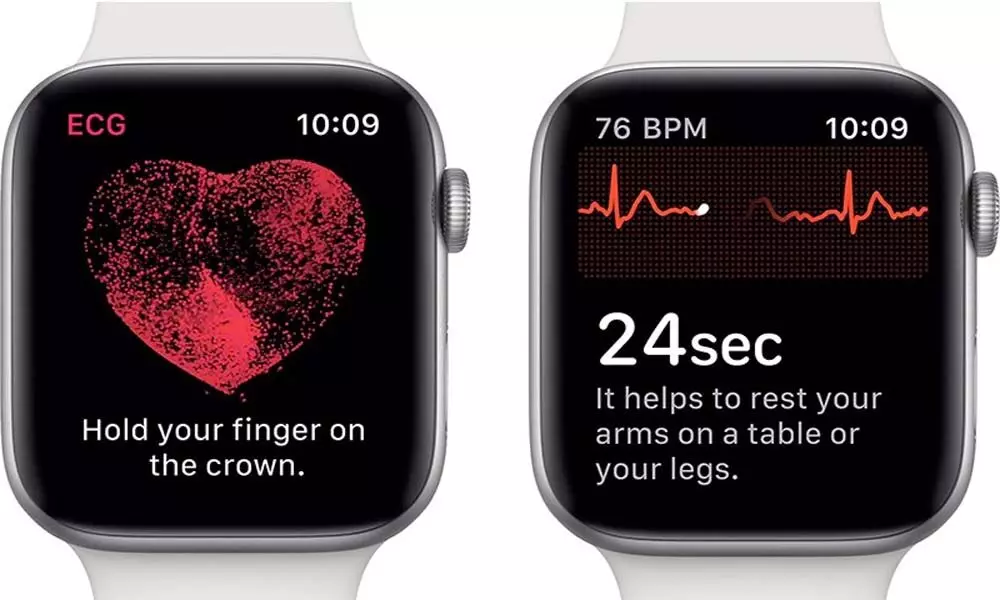 Apple Watch ECG gets green light in China