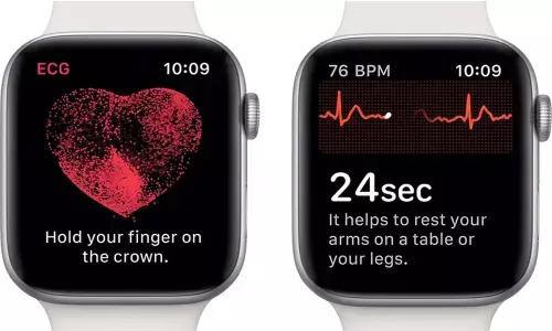 Apple Watch ECG gets green light in China