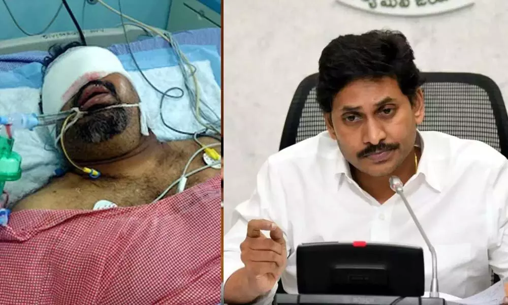 Andhra Pradesh:  Govt. releases financial assistance to Kathi Mahesh for his treatment