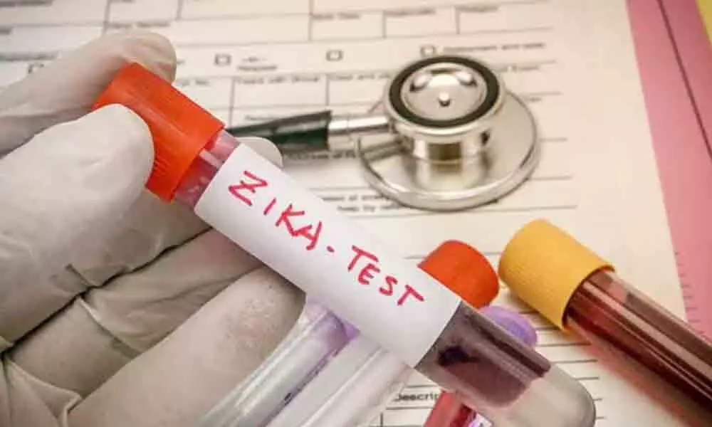 Family of Zika virus patient in Uttar Pradesh test negative