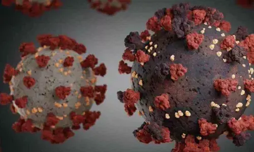 Representational Image