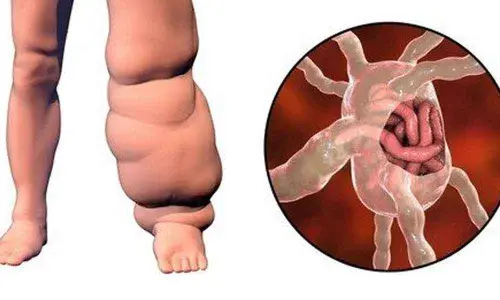 Representational Image