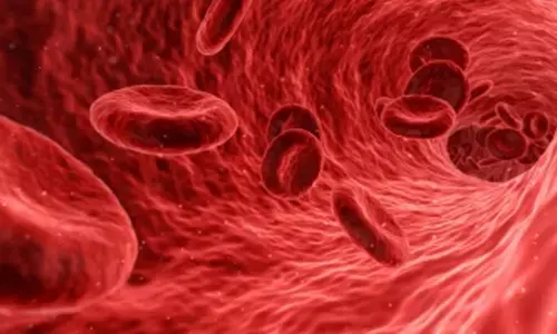 Treatment with blood thinners may reduce death in Covid patients
