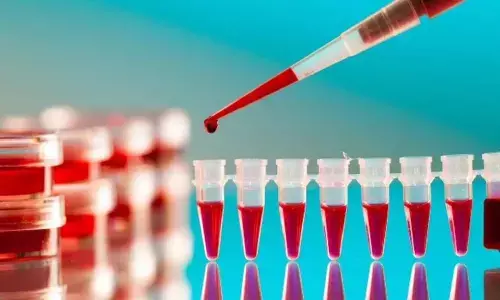 Now blood test for monitoring the infection caused by SARS-CoV-2