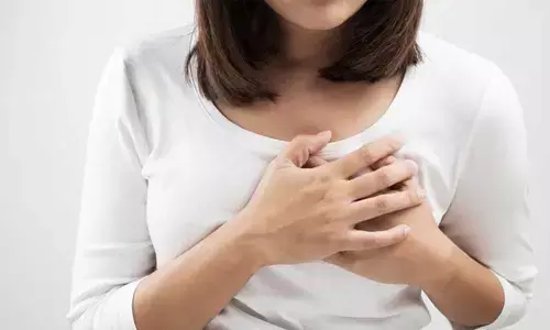 Representational image