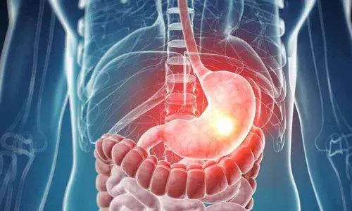 Representational image