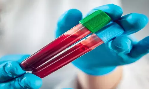 Combination of antiviral and anti-inflammatory drugs that can be used to treat Covid-19 patients