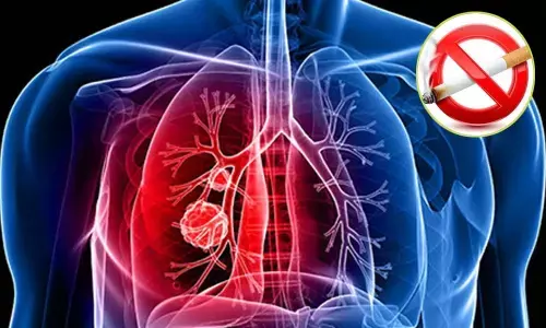 The things that matter for lung cancer