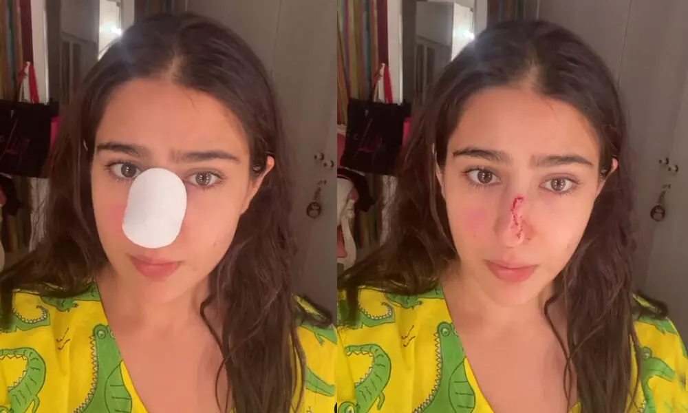 Sara Ali Khan Shows Off Her Injured Nose