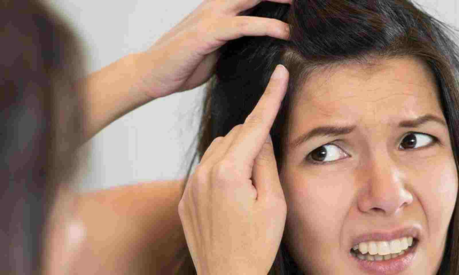 Premature grey hair? Natural remedies to fight it out