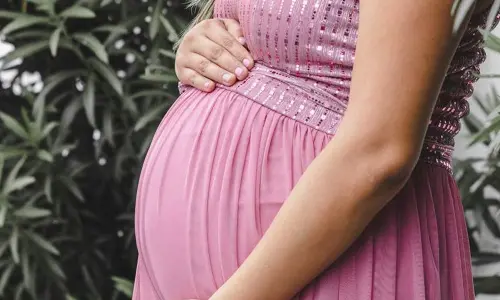 Representational image