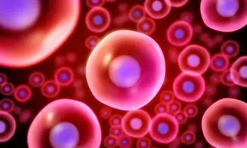 Representational Image