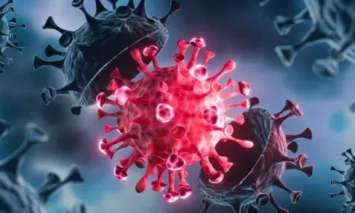 Representational Image