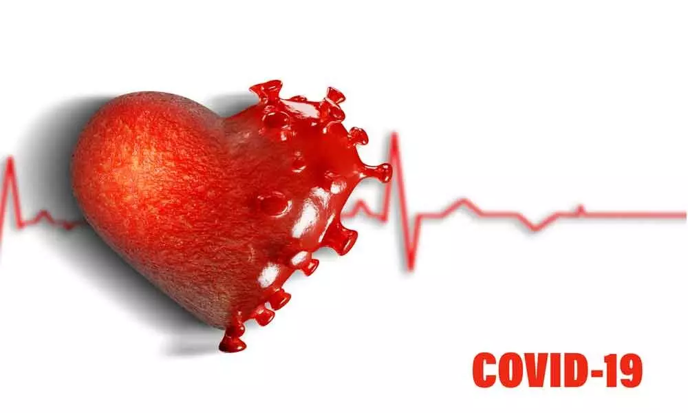 Covid-19 could lead to cardiac problems