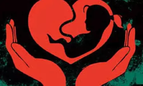 Representational image