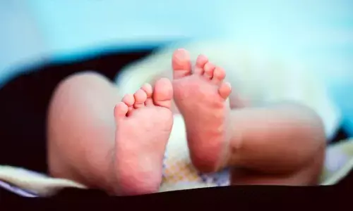 For representational purpose