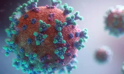 Representational image