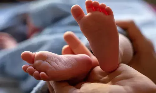 Representational image