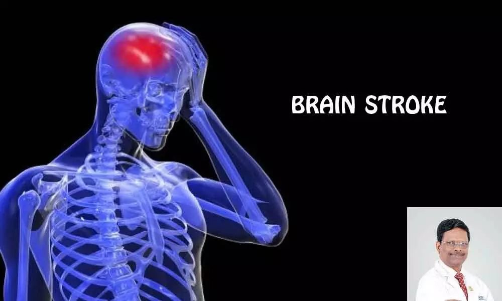 Importance of early treatment of brain stroke