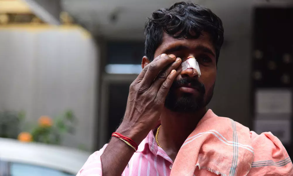Over 60 land in hospitals with eye injuries