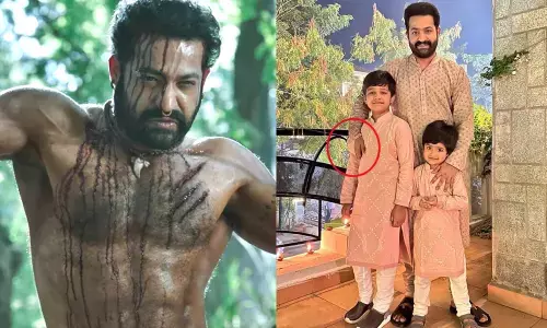 Finger surgery successful for NTR