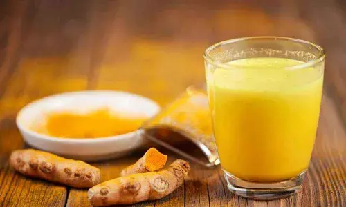 Representational Image Representational Image