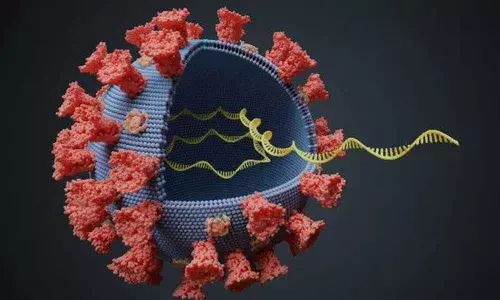 Representational Image