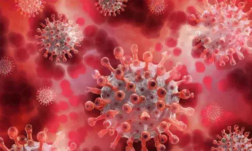 Representational Image