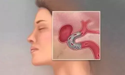 New generation flow diverter surgery saves two lives