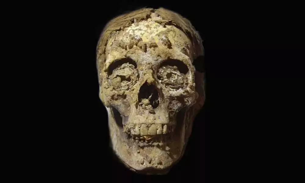 The ancient Egyptian mans skull and jawbone still contained the gold-foil tongue.