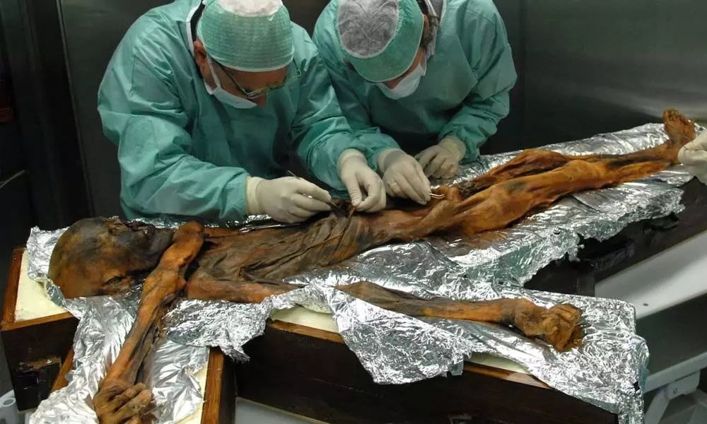 Researchers examining Ötzis mummy