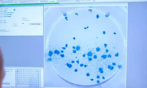 Omicron infects 70 times faster than Delta: Study