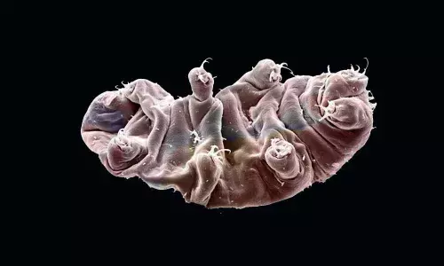 Physicists contends to have linked a superconducting qubit with a tardigrade