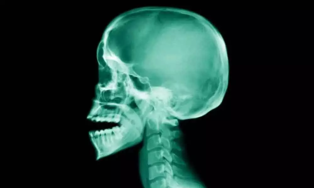 Researchers found a layer of muscle in the human jaw
