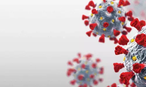 Representational Image