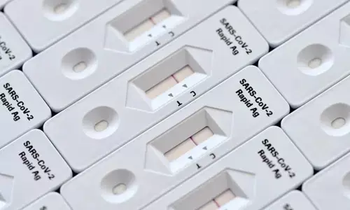 Telangana Government prods citizens to go in for RAT kits