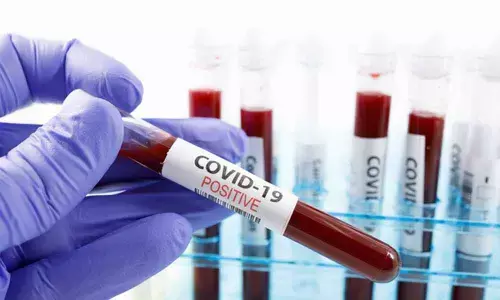 33 Chest Hospital staff test Covid positive