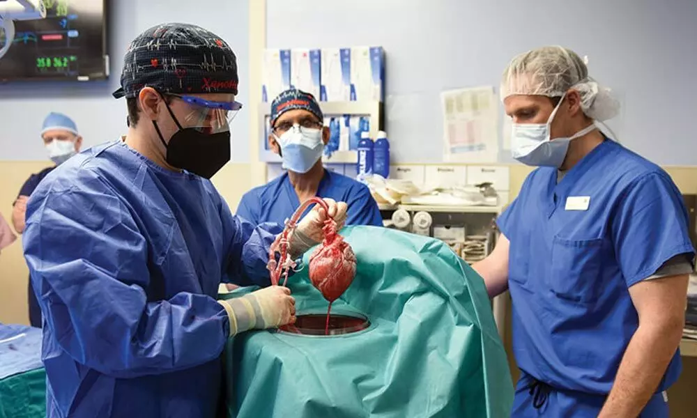 Surgeons examine the genetically engineered pig heart transplanted into a person last week.