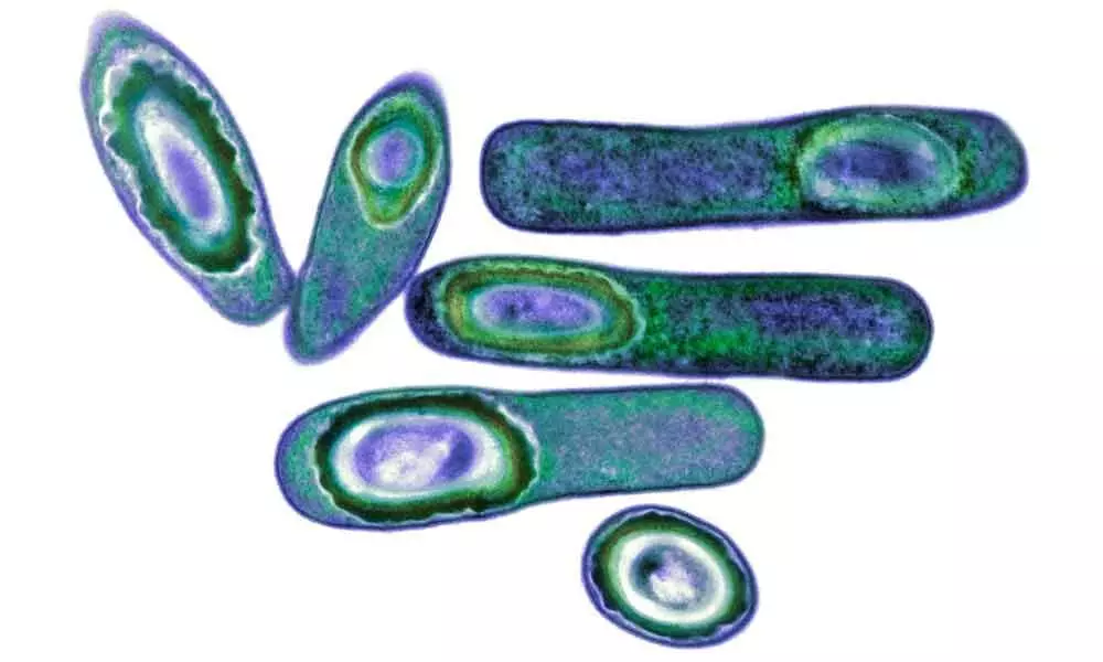 A microbiome-altering therapy cleared recurrent infections with the potentially deadly bacterium Clostridium difficile.BIOMEDICAL IMAGING UNIT/SOUTHAMPTON GENERAL HOSPITAL/SCIENCE SOURCE