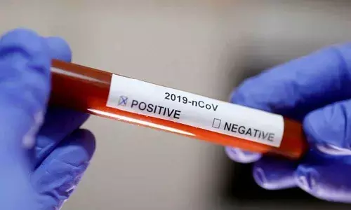 Representational Image