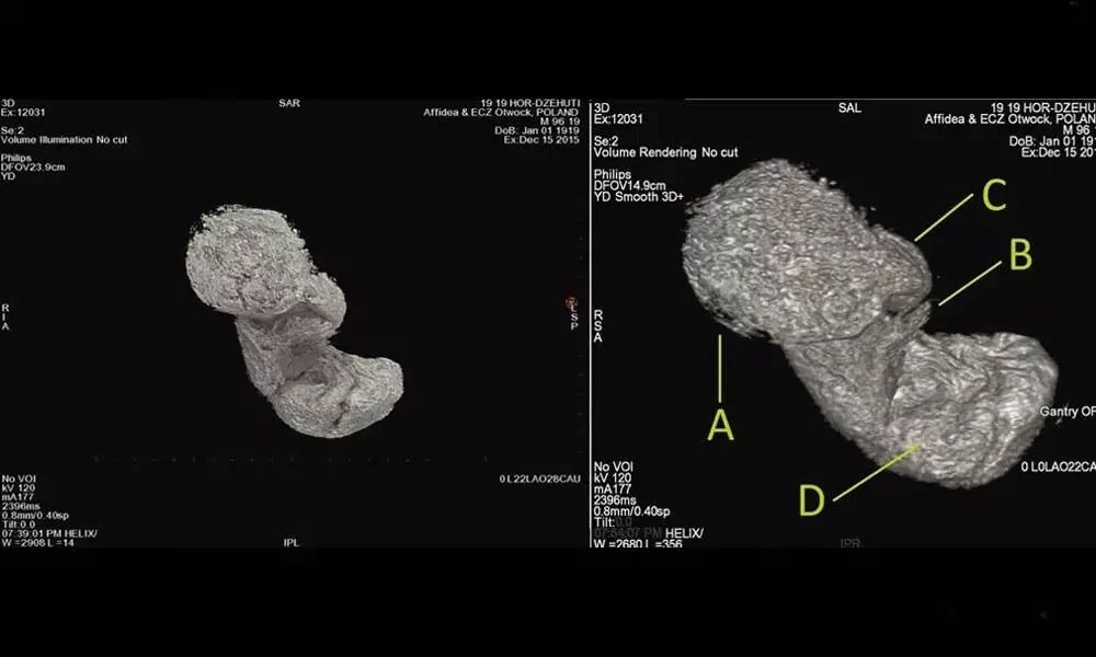 Volumetric rendering of fetus from CT data with interpretation. (Ejsmond et al., J. Archaeol. Sci., 2022)