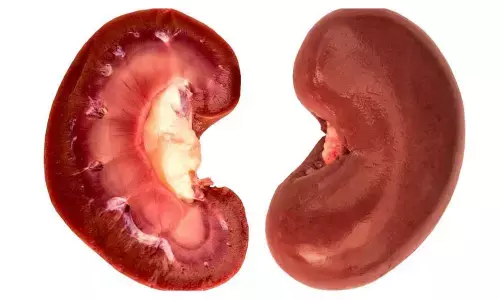 The pig had been genetically edited so that its organs were more compatible with human bodies,