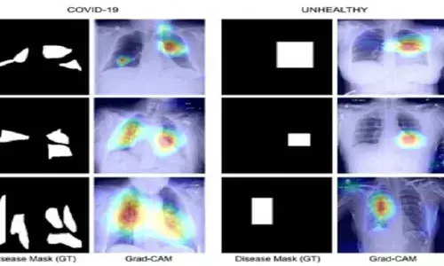 IIT-J develops Covid diagnosis technique