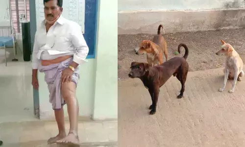 A civil supplies department dealer Obulesu showing his injuries from a dog bite