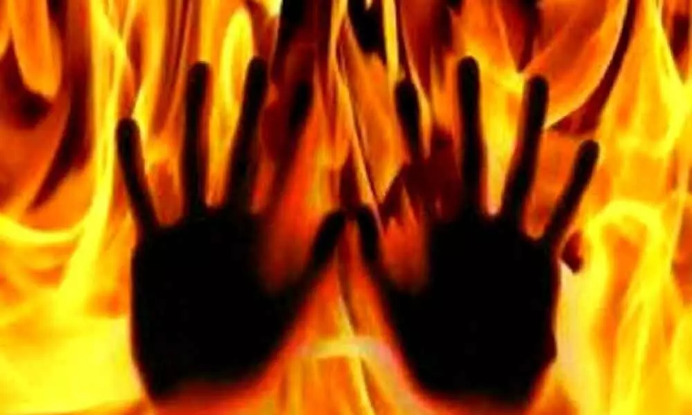 Two set on fire in UP village, accused held